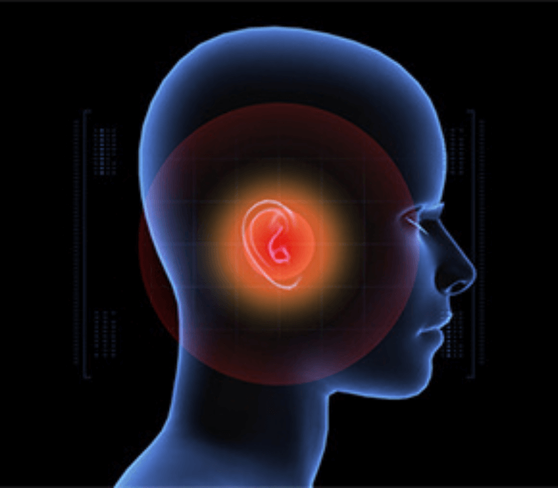 Arthocare coablation audiometer-pta/impedance hearing  aids