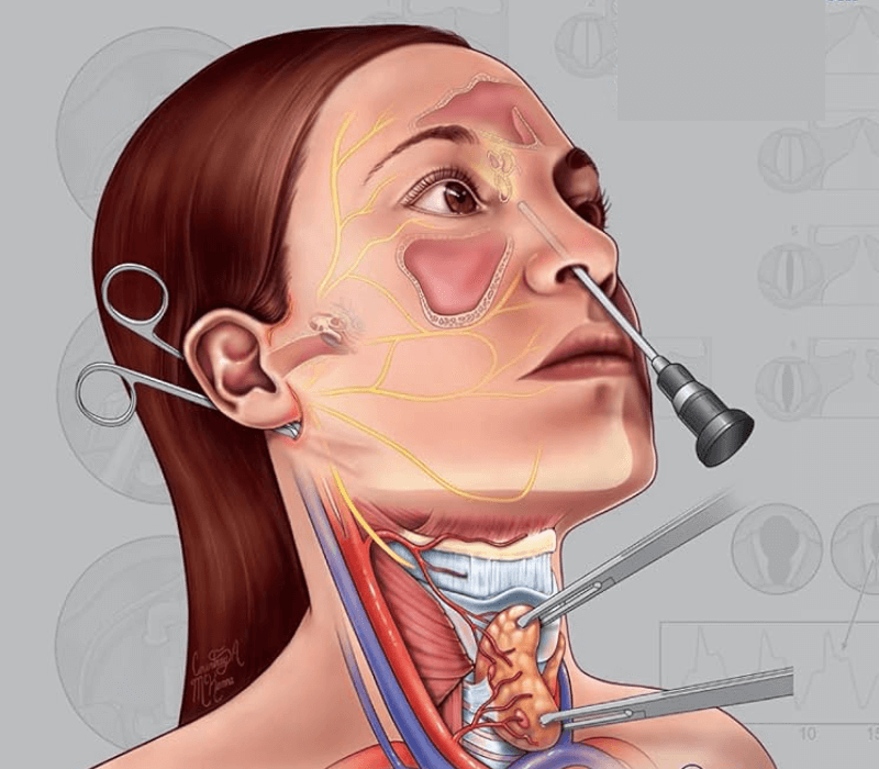 Head &Neck surgery 