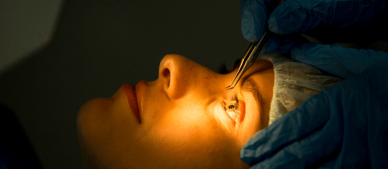 Lasik Laser for Distance Vision