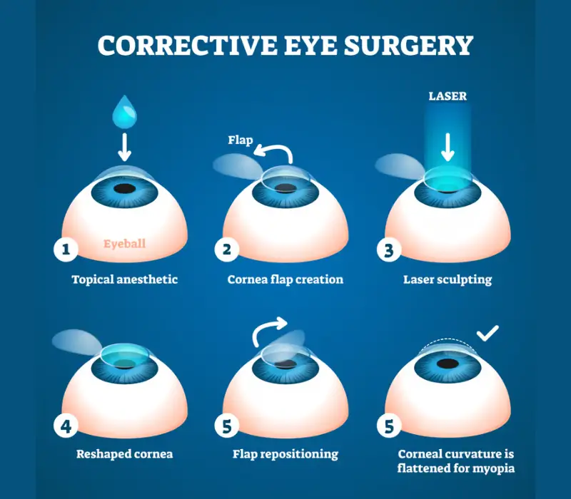 Presbyond laser for near vision 