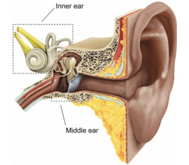 Stapedectomy /mestoidectomy 